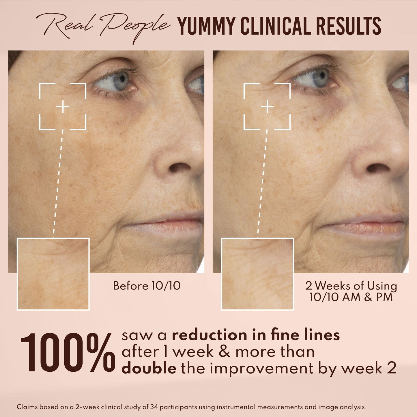 Yummy Skin 10/10 Barrier Boost Hyaluronic Acid + Ectoin Plumping Serum
